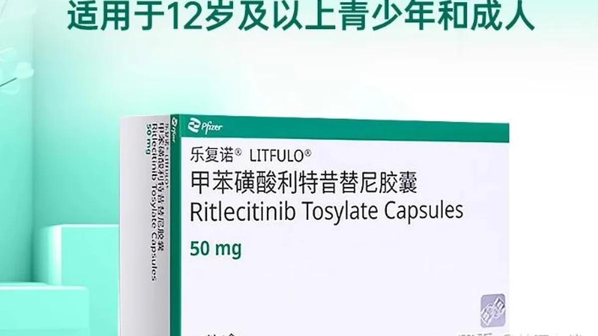 医生正在向家长解释儿童斑秃用药注意事项